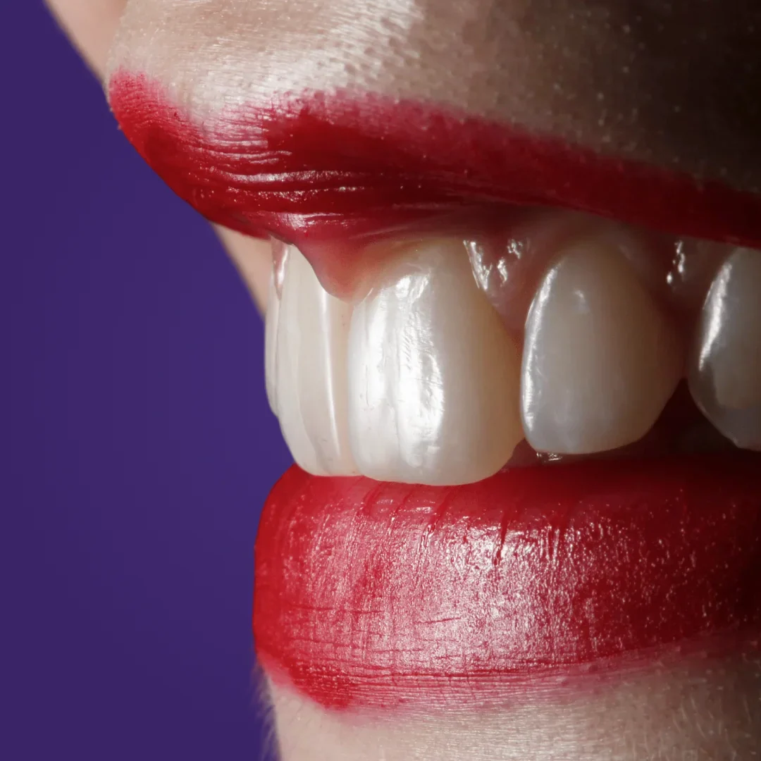 Odhalené zubné krčky – čo s nimi a ako im predchádzať?